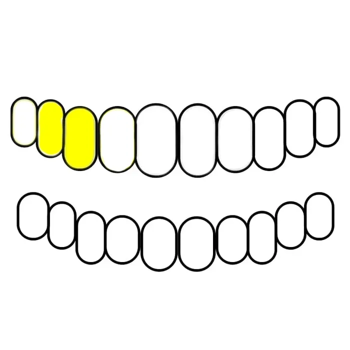 Bling Cartel Admin 10K Gold Double OpenSolid Custom Caps Canine 1st Premolar Rings