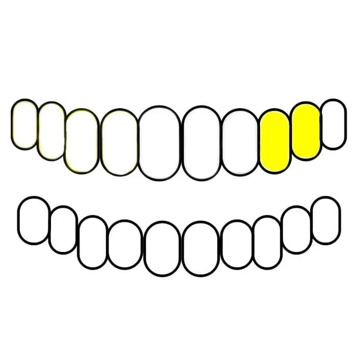 Bling Cartel Admin 10K Gold Double OpenSolid Custom Caps Canine 1st Premolar Rings