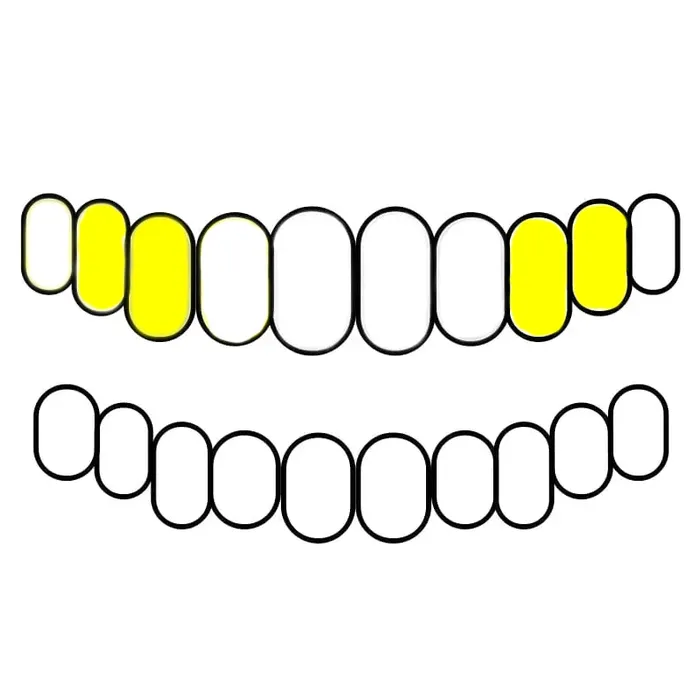 Bling Cartel Admin 10K Gold Double OpenSolid Custom Caps Canine 1st Premolar Rings