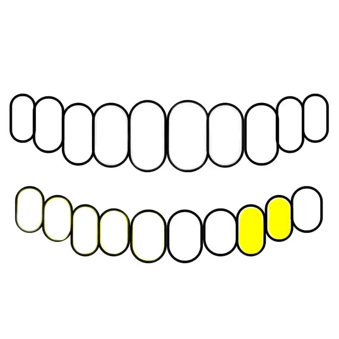 Bling Cartel Admin 10K Gold Double OpenSolid Custom Caps Canine 1st Premolar Rings