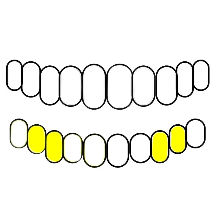 Bling Cartel Admin 10K Gold Double OpenSolid Custom Caps Canine 1st Premolar Rings