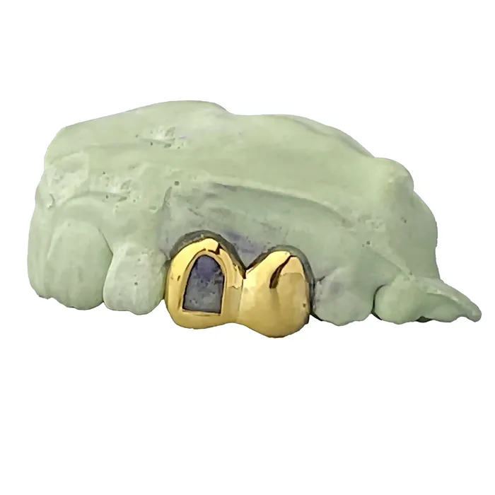 Bling Cartel Admin 10K Gold Double OpenSolid Custom Caps Canine 1st Premolar Rings
