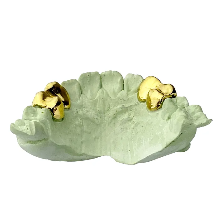 Bling Cartel Admin 10K Gold Double OpenSolid Custom Caps Canine 1st Premolar Rings
